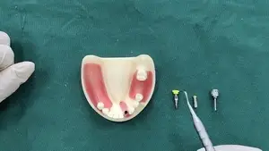 نظام الطبعة المغلقة لزرعات الأسنان (Closed Tray)