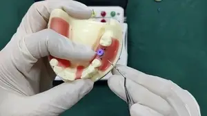 غطاء الالتئام لنظام زراعة الأسنان BLE